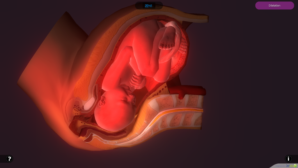 scène d'accouchement en 3D