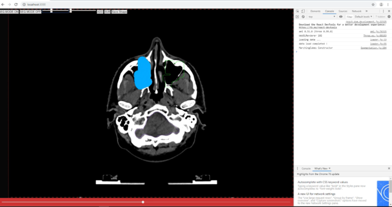 Deep_learning_Medical